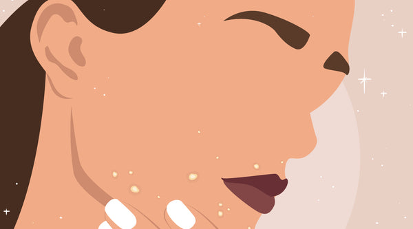 Top Hormonal Acne Skincare & Serum Tips