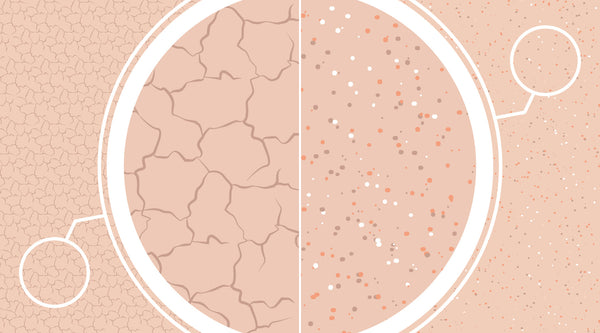 Dry vs Dehydrated Skin: Key Differences