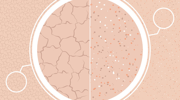 Dry vs Dehydrated Skin: Key Differences