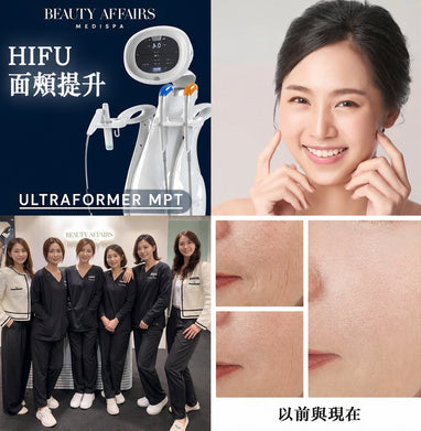 HIFU Ultraformer MPT 緊致蘋果肌療程 - 中環