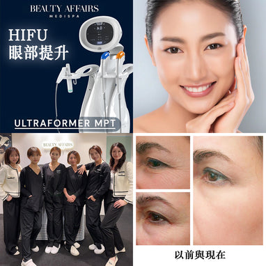 个人化 HIFU 眼部紧緻提拉疗程丨亨利中心