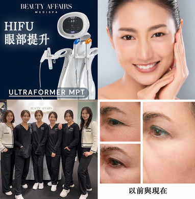 個人化 Ultraformer HIFU 鋼筋索提拉療程- 亨利中心