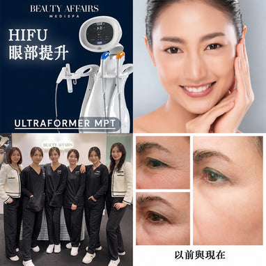 HIFU Eye Lifting Ultraformer MPT Treatment - Henry House