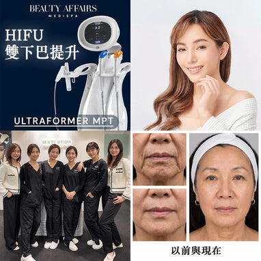个人化 HIFU V面及颈部提升紧緻疗程- 中环