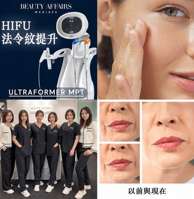 HIFU Ultraformer MPT 虎紋除皺療程 - 中環